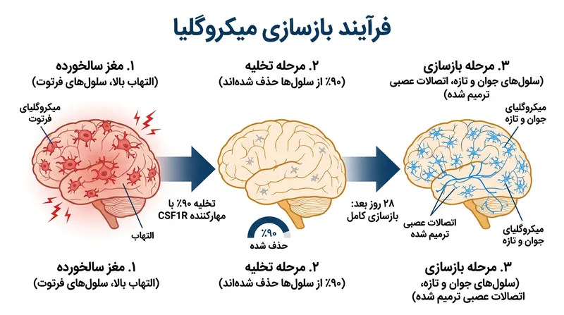 فرآیند سهمرحلهای تخلیه و بازسازی سیستم ایمنی مغز.