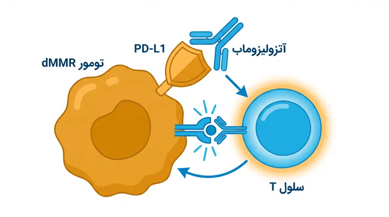 آتزولیزوماب «پوشش نامرئی» PD-L1 را که تومورهای dMMR برای پنهان شدن استفاده می‌کنند، خنثی کرده و به سیستم ایمنی اجازه حمله می‌دهد.