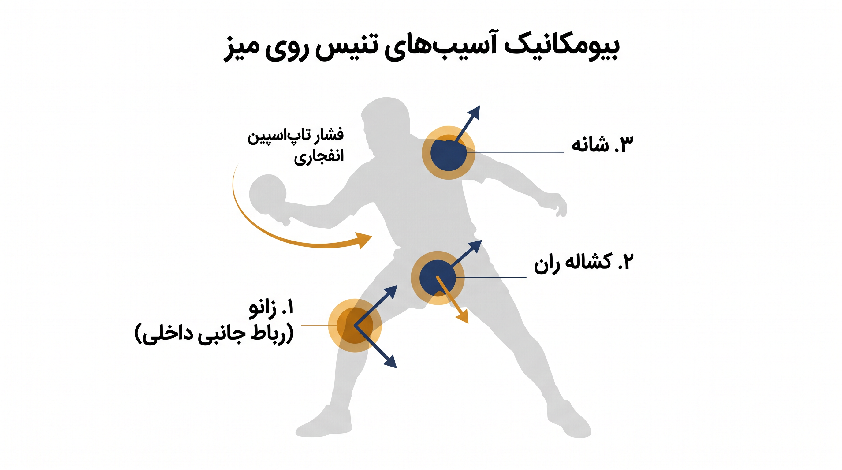 گشتاور چرخشی تکراری درایو فورهند مدرن، فشار زیادی بر قسمت پایین تنه وارد میکند.