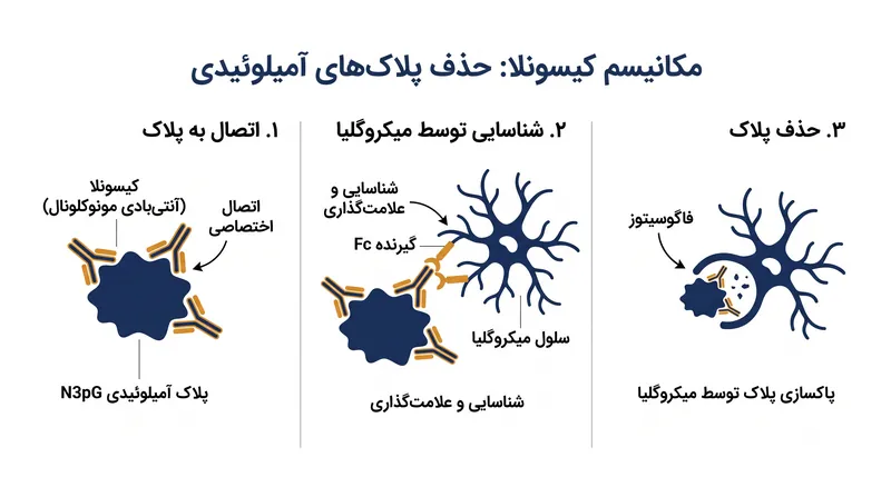 نحوه عملکرد کیسونلا: این آنتی‌بادی به پلاک‌های آمیلوئیدی سخت‌شده متصل می‌شود و به سیستم ایمنی اجازه می‌دهد تا آنها را پاکسازی کند.