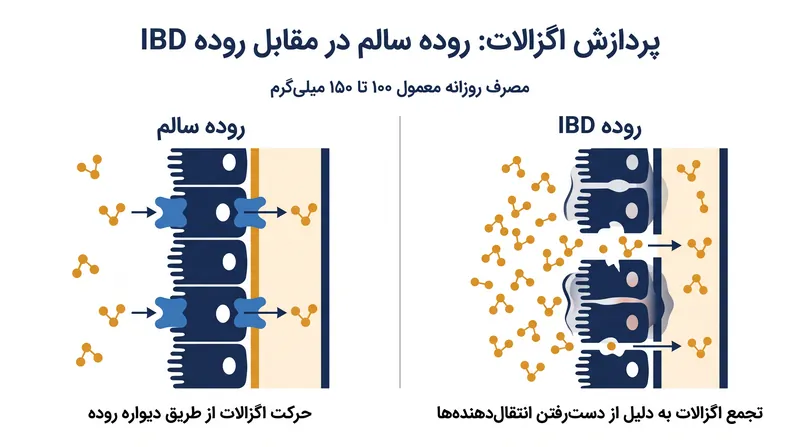 چگونه از دست دادن انتقال‌دهنده‌های تخصصی باعث تجمع اگزالات در روده ملتهب می‌شود.