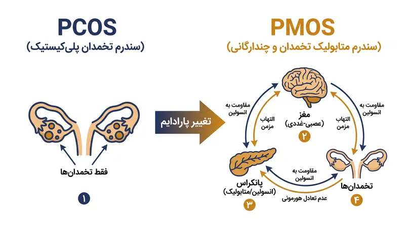 نام اختصاری جدید PMOS بر محرک‌های سیستمیک متابولیک و غدد درون‌ریز این بیماری تأکید می‌کند.
