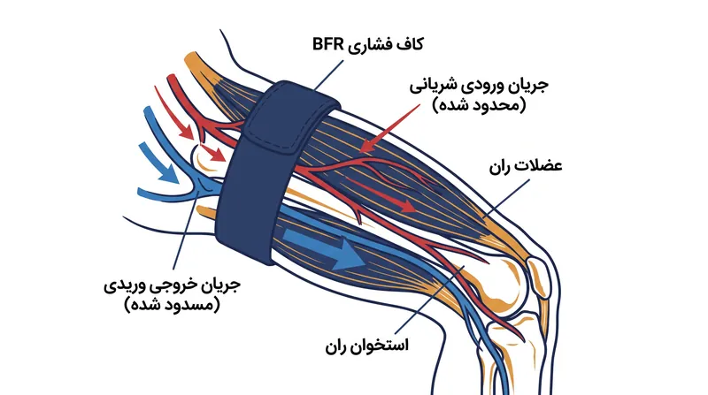 BFR با محدود کردن جزئی جریان شریانی و مسدود کردن بازگشت وریدی، یک محیط هیپوکسیک موضعی ایجاد می‌کند که رشد عضلانی را تحریک می‌نماید.