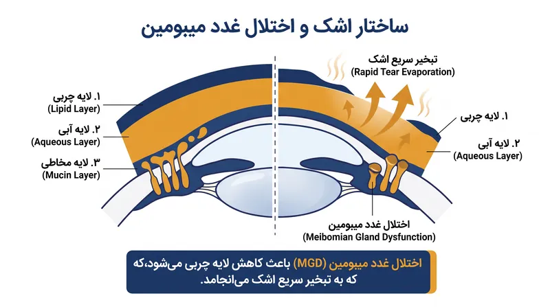 لایه اشک برای جلوگیری از تبخیر لایه آبی خود، به یک لایه چربی بیرونی متکی است.