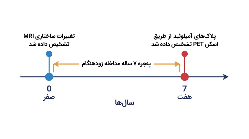 مطالعه اسلو شکاف هفت ساله بین تغییرات ساختاری مغز و ظهور پلاک‌های آمیلوئید را آشکار کرد.