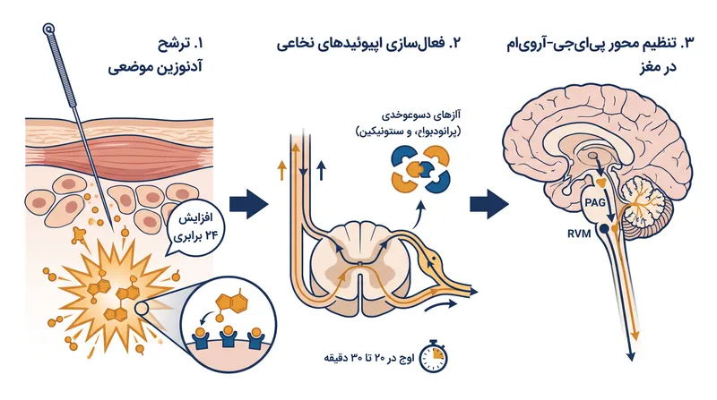 واکنش فیزیولوژیکی سه‌مرحله‌ای که با ورود سوزن طب سوزنی در بدن ایجاد می‌شود.