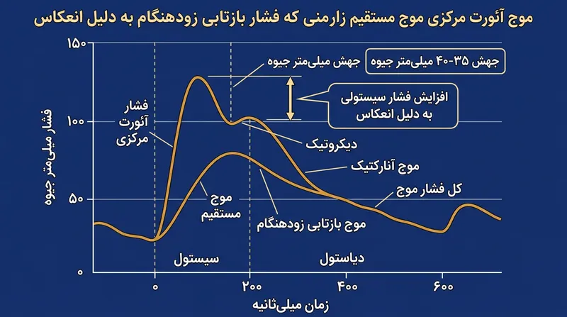بازگشت زودهنگام موج بازتابی با ضربان فعال قلب تلاقی پیدا کرده و جهشی چشمگیر در عدد بالایی فشار خون می‌آفریند.