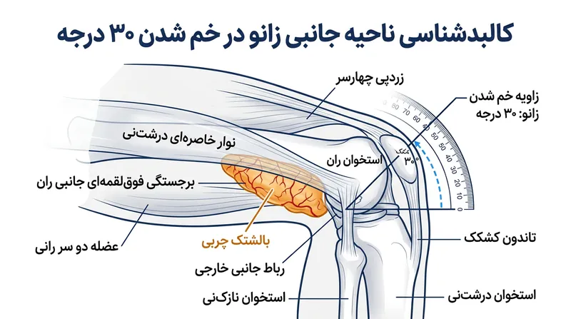 نوار ایلیوتیبیال به جای بورس، یک پد چربی پر از پایانه‌های عصبی را در زاویه ۳۰ درجه خمیدگی روی استخوان می‌فشارد.