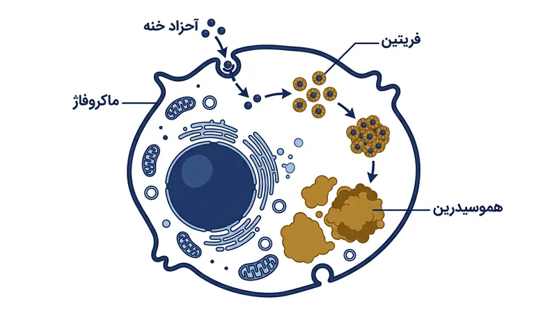 ماکروفاژها آهن آزاد و پرخطر را درون کمپلکس‌های قهوه‌ای-طلایی هموسیدرین حبس می‌کنند که می‌تواند سایه‌ای برنزه روی پوست به جا بگذارد.