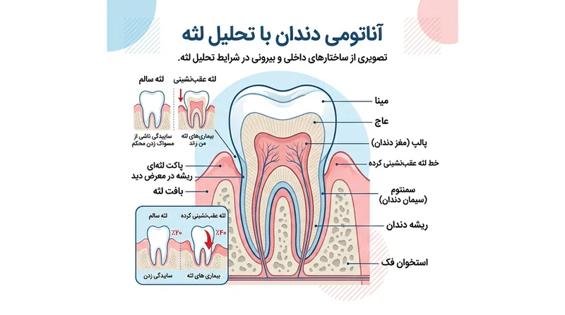 آناتومی دندان و نحوه قرارگیری ریشه در معرض آسیب پس از عقب‌نشینی لثه.