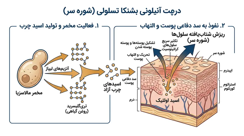 مخمرهای مالاسزیا آنزیم‌هایی ترشح می‌کنند که روغن‌های گیاهی را تجزیه کرده و اسید اولئیک تحریک‌کننده به جا می‌گذارد.