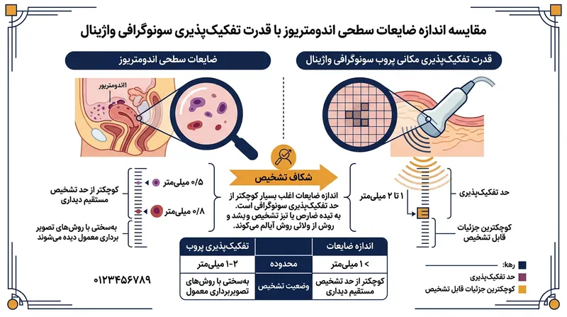ضایعات سطحی صفاق از نظر ابعاد فیزیکی کوچک‌تر از حداقل تفکیک‌پذیری مکانی دستگاه‌های رایج سونوگرافی بالینی هستند.