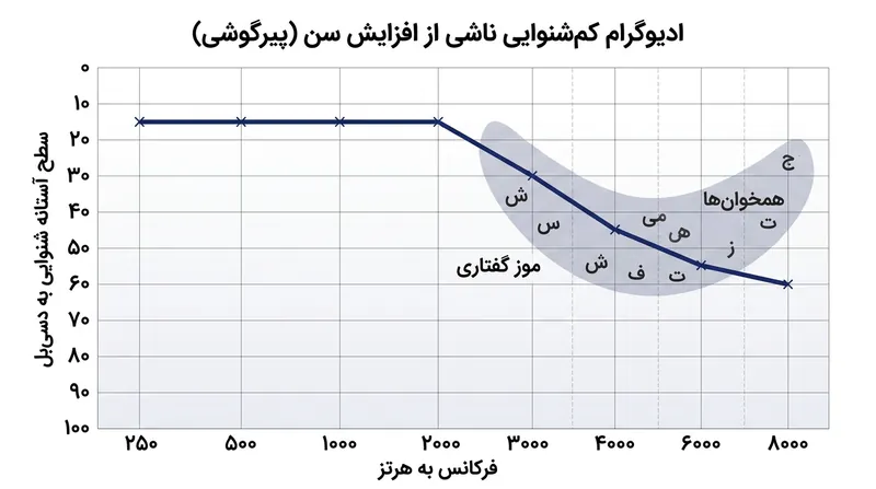 ادیوگرام معمولی پیرگوشی نشان‌دهنده حفظ سلامت شنوایی در اصوات بم همزمان با افت محسوس در فرکانس‌های بالاست.