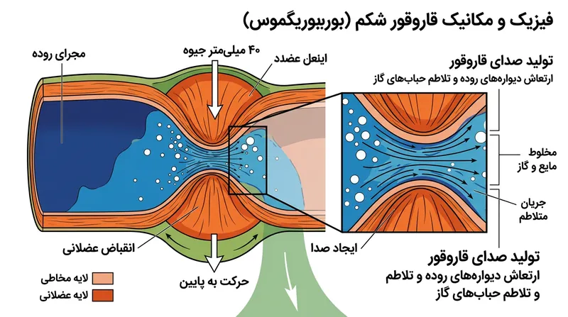 قاروقور شکم زمانی رخ می‌دهد که امواج عضلانی پرفشار، گاز و مایع محبوس را از بخش‌های باریک روده عبور می‌دهند.