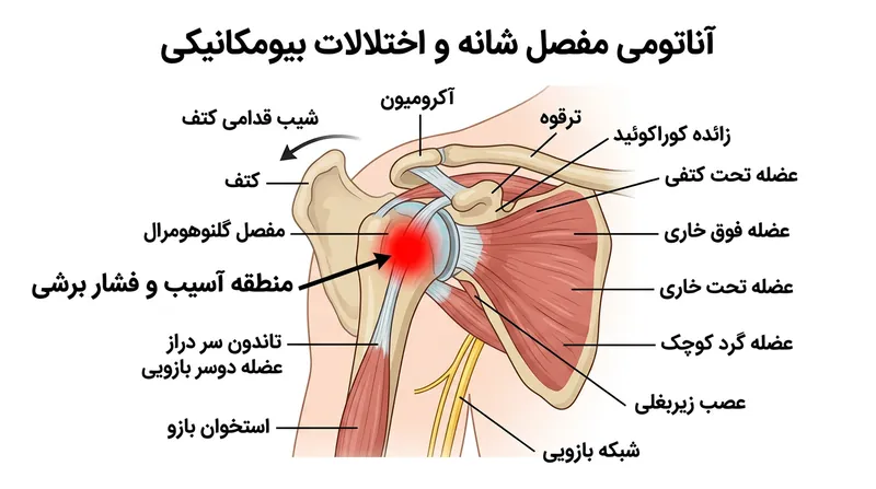 چرخش قدامی کتف، حفره مفصل را به سمت پایین متمایل کرده و استخوان بازو را به کپسول شکننده جلوی شانه می‌کوبد.