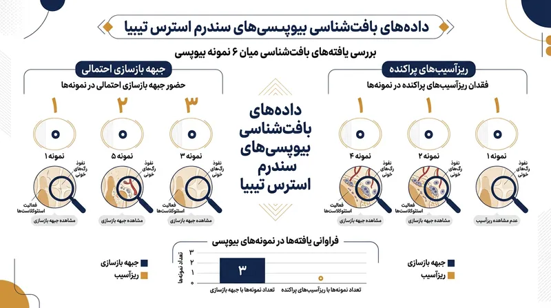 بیوپسی ورزشکاران مبتلا به درد ساق پا هیچ اثری از ریزآسیب‌های پراکنده یا التهاب ناشی از پارگی عضلانی نشان نمی‌دهد.