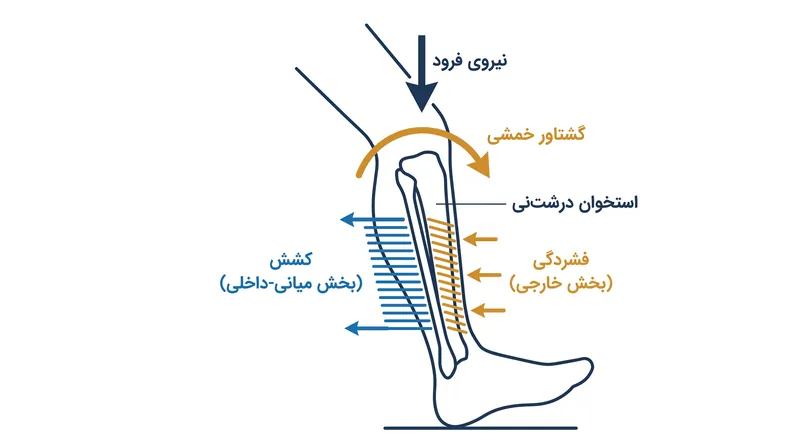 در فاز فرود پا، استخوان درشت‌نی مانند یک فنر تحت بار عمل کرده و بر اثر وزن دونده دچار انحنا و کشش در بخش داخلی می‌شود.