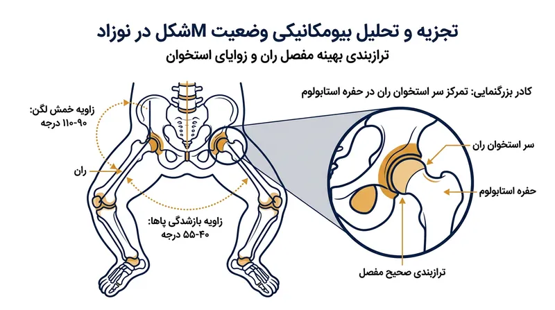 هندسه بهینه مفصل لگن نیازمند ۴۰ تا ۵۵ درجه ابداکشن و ۹۰ تا ۱۱۰ درجه فلکشن است تا سر استخوان ران کاملاً در مرکز حفره قرار گیرد.