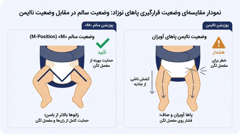آغوشی‌های باریک پاها را در حالت آویزان و کشیده رها می‌کنند که باعث خروج سر استخوان ران از گودی مفصل می‌شود.