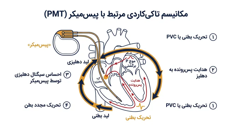 مدار چرخه بی‌پایان برای هدایت رو به جلو بر ضربان‌ساز و برای هدایت رو به عقب بر بافت خود قلب متکی است.
