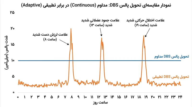 مقایسه ارسال مداوم پالس در سیستم‌های سنتی با ارسال هوشمند در سیستم‌های تطبیقی (aDBS).