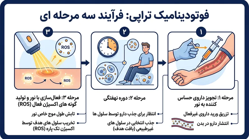 سه مرحله اصلی درمان فتودینامیک: تزریق دارو، زمان انتظار و تابش نور.