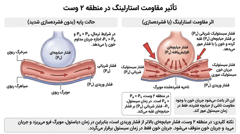 در ناحیه ۲ وست، مویرگ ریوی شبیه مقاومت استارلینگ عمل می‌کند و جریان خون با فشار خارجی آلوئول متسع مسدود می‌شود.