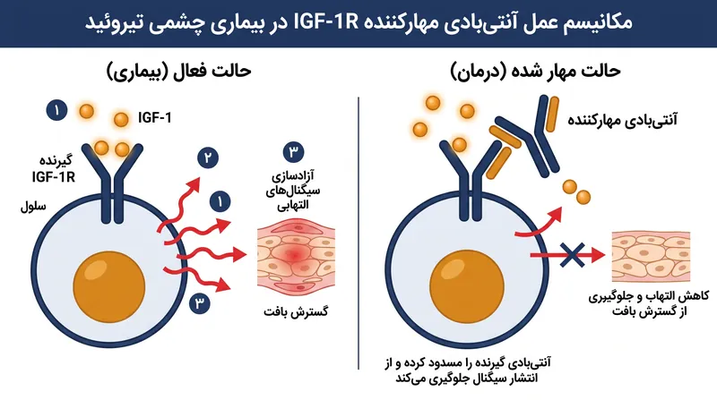 لوموا با مسدودسازی کامل گیرنده IGF-1R، آبشار التهابی را که منجر به گسترش بافت پشت چشم می‌شود، متوقف می‌کند.