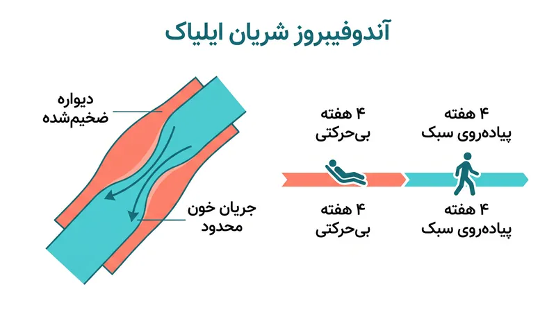 لیزا پرترر برای آندوفیبروز شریان ایلیاک، وضعیتی شایع در دوچرخه‌سواران که جریان خون به پاها را محدود می‌کند، تحت عمل جراحی قرار گرفت.