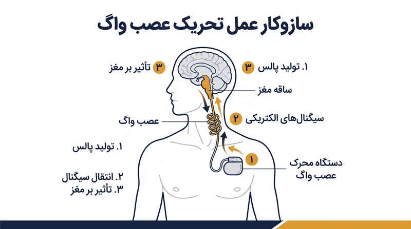 دستگاه کاشته‌شده پالس‌های الکتریکی پیوسته‌ای را از طریق عصب واگ به بالا می‌فرستد و مراکز خلق و خو در مغز را از «پایین به بالا» تعدیل می‌کند.