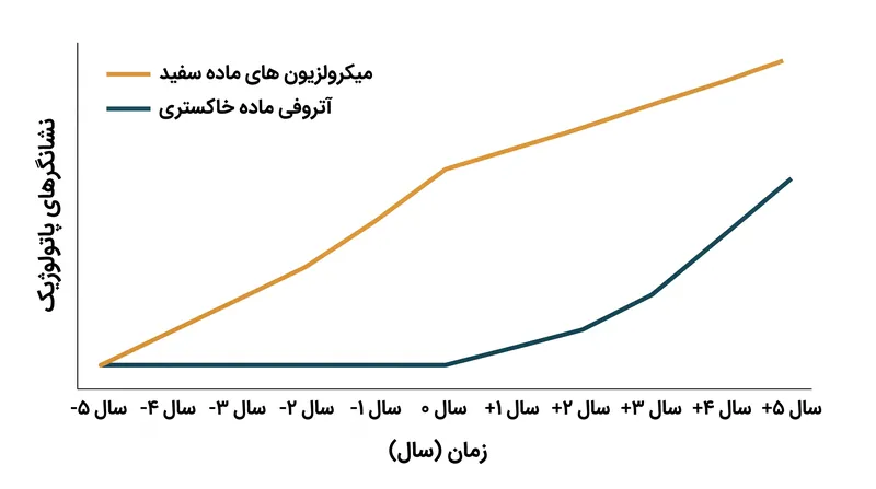 تخریب ماده سفید سه تا پنج سال قبل از آسیب قابل اندازه‌گیری ماده خاکستری رخ می‌دهد و پنجره جدیدی برای مداخله زودهنگام ارائه می‌دهد.
