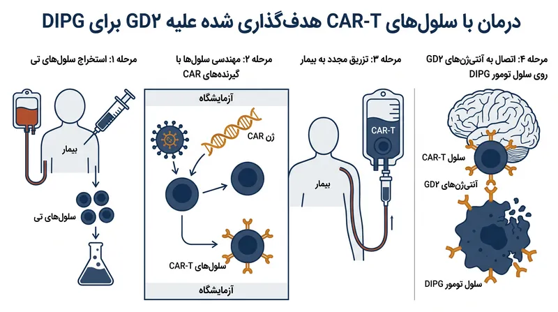نحوه مهندسی سلول‌های CAR-T برای هدف قرار دادن مولکول GD۲ در تومورهای DIPG.