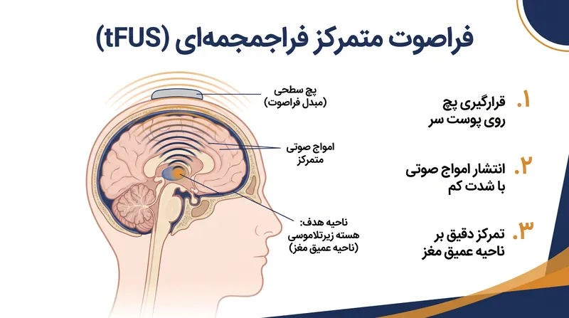 فراصوت متمرکز فراجمجمه‌ای (tFUS) به محققان این امکان را می‌دهد که هسته زیرتلاموسی را بدون نیاز به ایمپلنت‌های جراحی هدف قرار دهند.