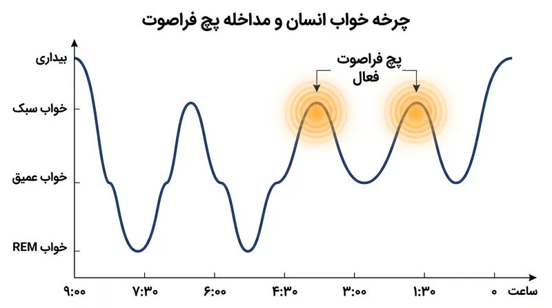 سیستم حلقه بسته شروع چرخه‌های خواب را تشخیص می‌دهد و برای حفظ فاز رِم، تحریک صوتی ارائه می‌دهد.