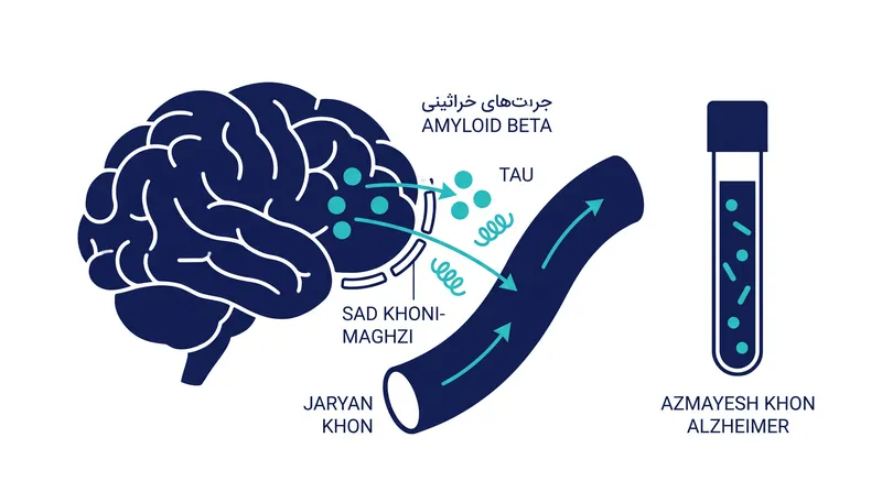 این آزمایش نسبت پروتئین‌های آمیلوئید بتا و پی-تاو ۲۱۷ را که از مغز وارد جریان خون می‌شوند، اندازه‌گیری می‌کند.